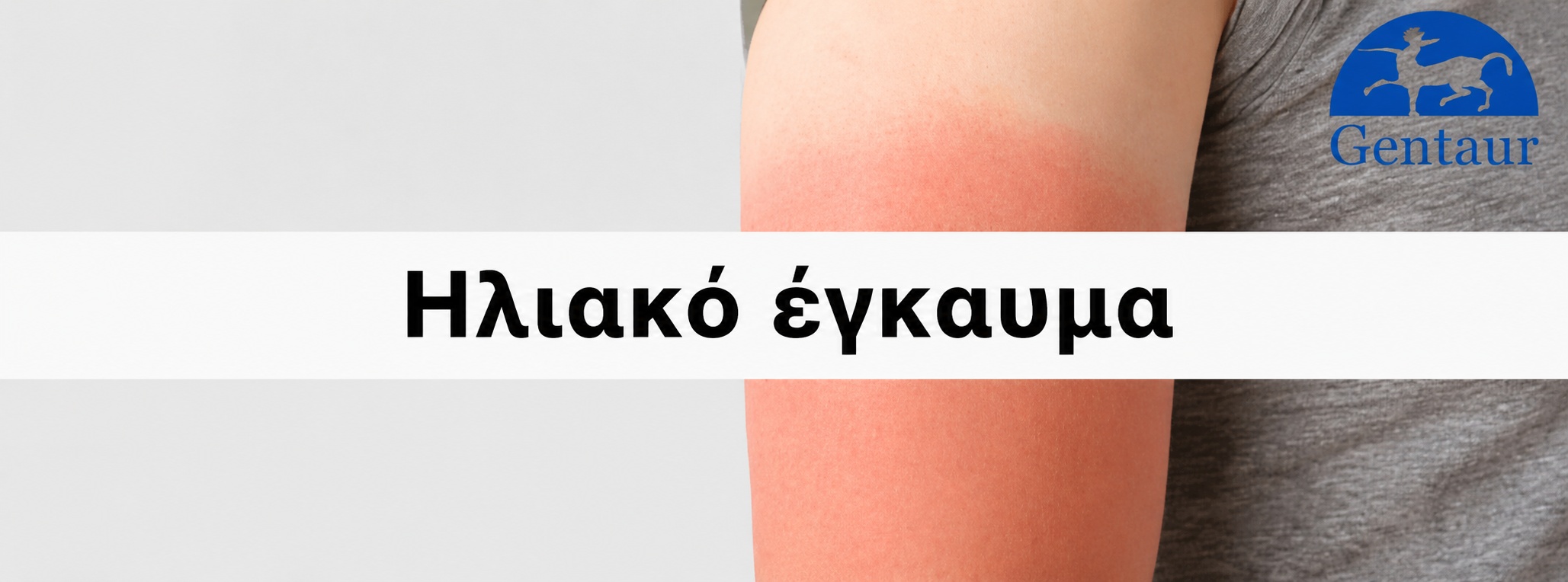 Ηλιακό έγκαυμα – πώς να απολαμβάνετε τον ήλιο με ασφάλεια?